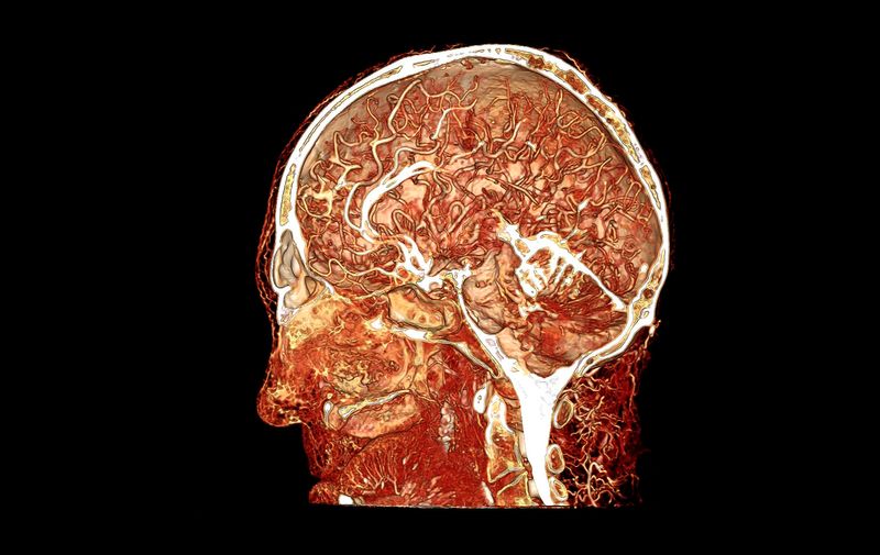 Microvasculature of human head and brain by Scott Echols