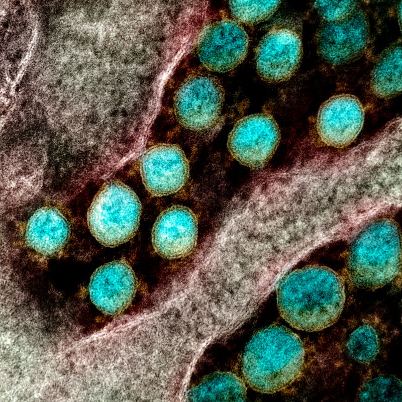 scanning electron micrograph of SARS-CoV-2, shown as blue blobs
