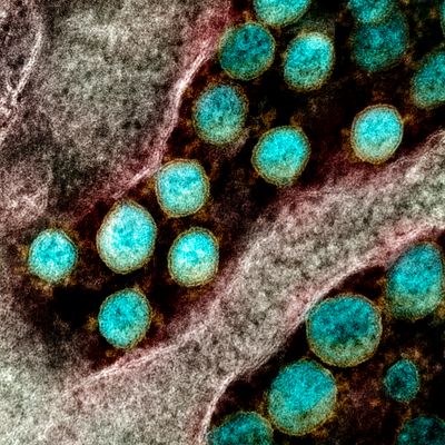 scanning electron micrograph of SARS-CoV-2, shown as blue blobs